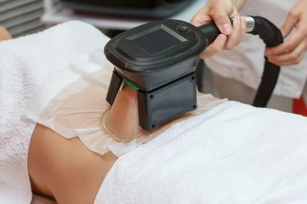 Image of person having fat freezing treatment to help weight gain Colchester