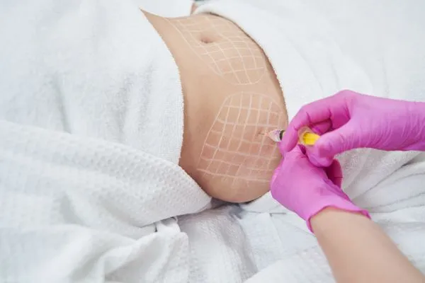 image of fat dissolving injections on love handles to help combat weight gain Colchester