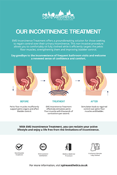 image to show how EMS treatment works for female urinary incontinence Colchester