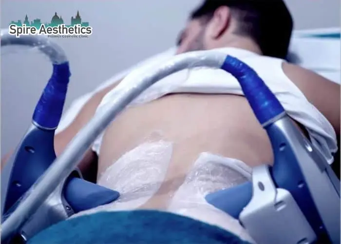 Man having fat freezing treatment done on love handles before a competitions Colchester to create a sculpted look.