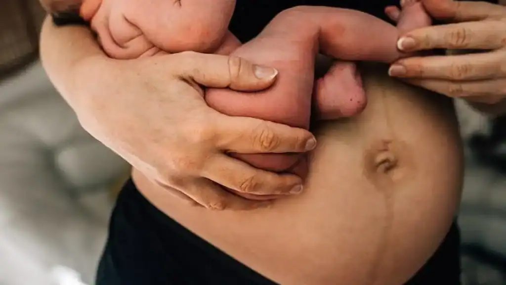Why Is My Stomach Still Big After Pregnancy Colchester?