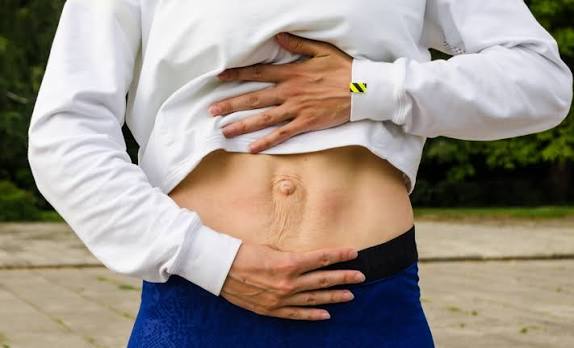 When Could Diastasis Recti Be the Missing Piece of the Puzzle Colchester?